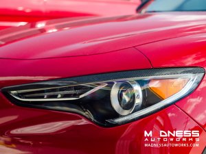 Alfa Romeo Stelvio Headlight Trim Kit - Carbon Fiber Alfa Romeo Stelvio Headlight Trim Kit - Carbon Fiber